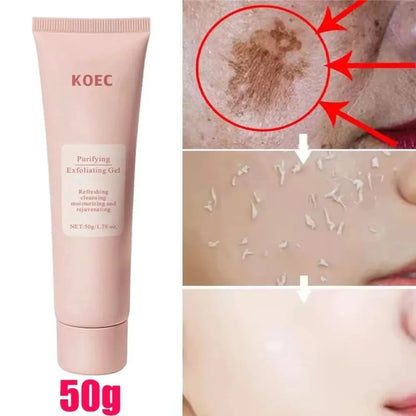 Clareluz® Exfoliante Anti-Acné para Manchas y Piel Lisa